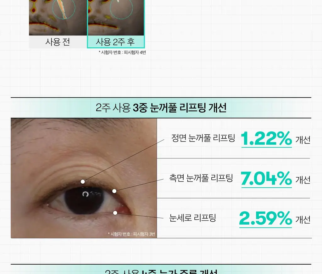 [베일리pick/단독기획] VT 피디알엔 리들샷 아이 리프터 15ml 리필기획 (+리필 15ml) 상세페이지 22